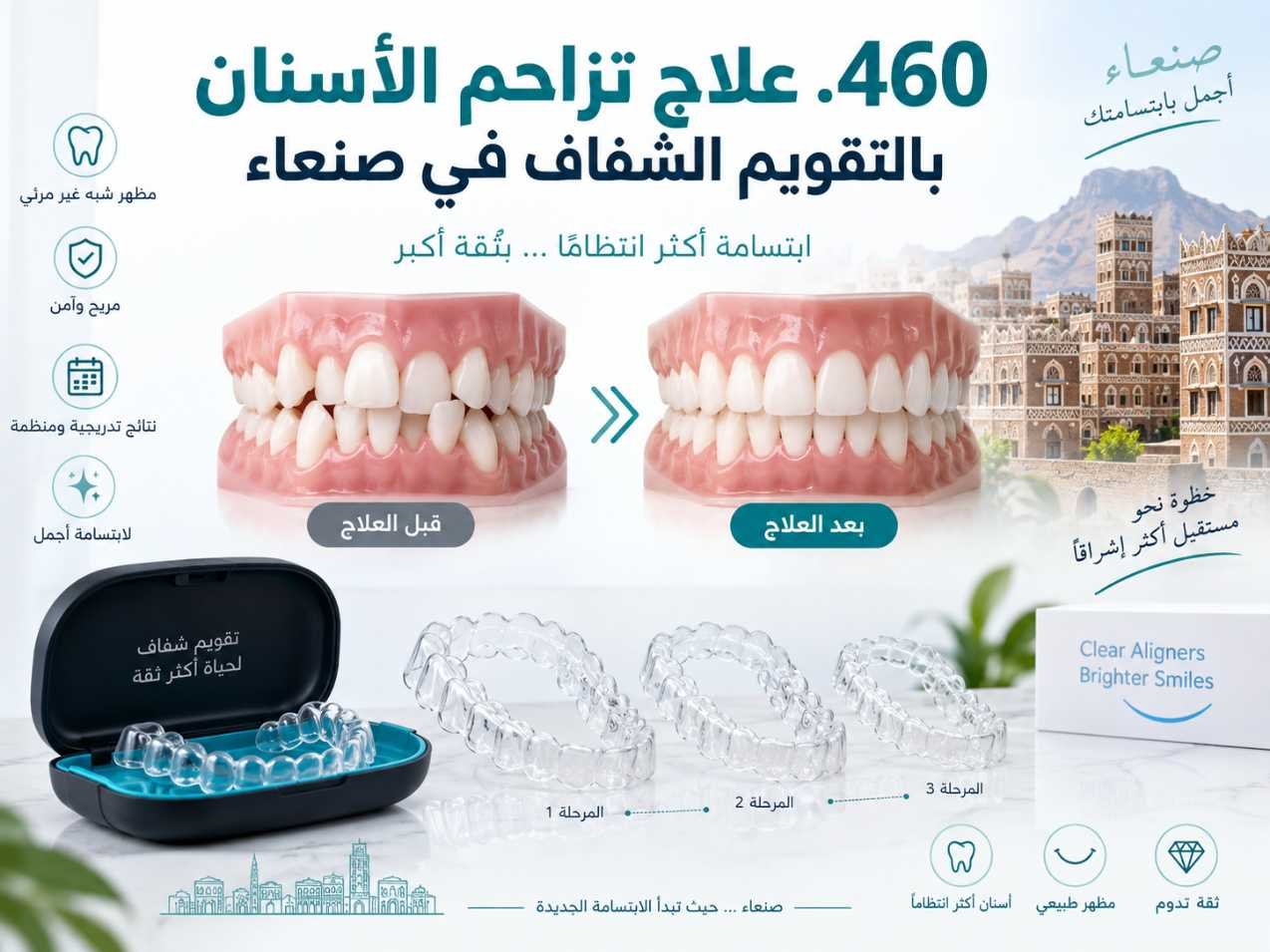 علاج تزاحم الأسنان بالقوالب الشفافة: متى يكون مناسبًا؟