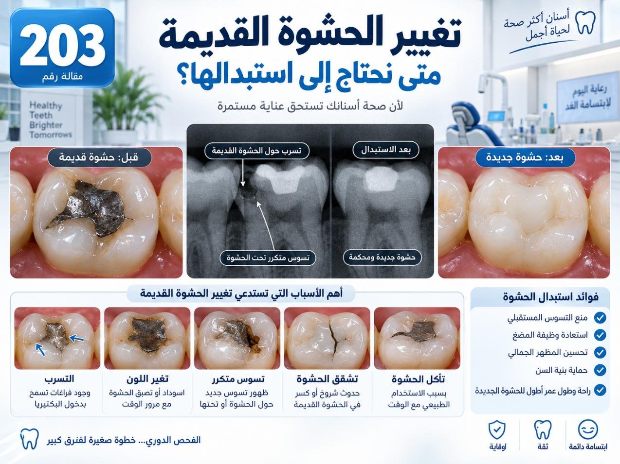 تغيير الحشوة القديمة: الأسباب والتشخيص وخيارات العلاج