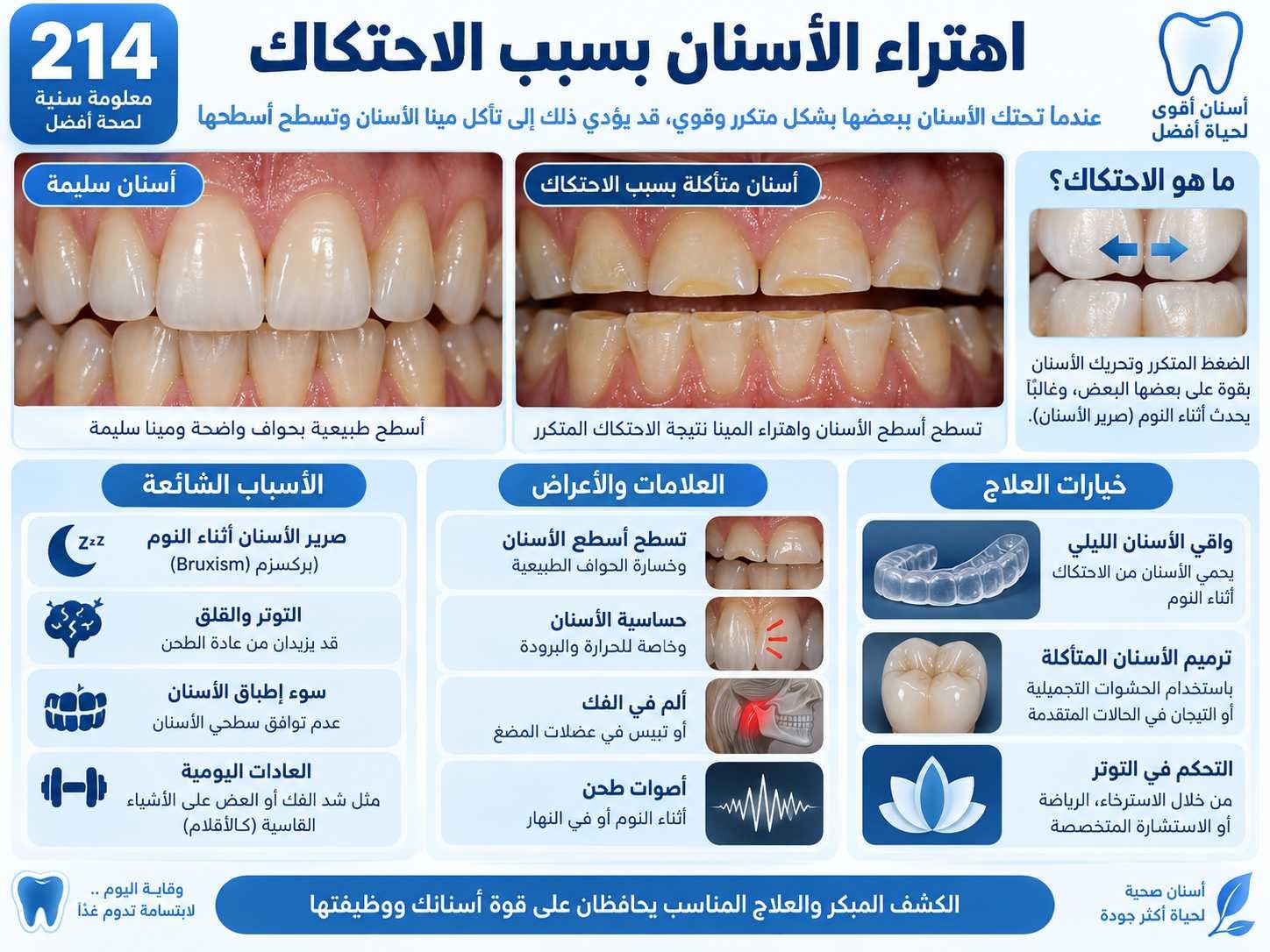 اهتراء الأسنان بسبب الاحتكاك: الأسباب والتشخيص وخيارات العلاج